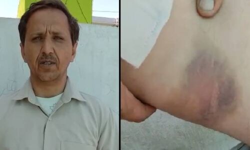 लॉकडाउन में फंसे मजदूरों को गोरखपुर छोड़ने गए रोडवेज ड्राइवर को यूपी पुलिस ने बेरहमी से पीटा