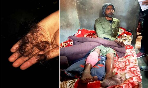 यूपी पुलिस पर लगा दिल्ली के विधायक अमानतुल्लाह खान के परिजनों को पीटने का आरोप