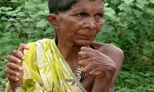ओडिशा की 31 उंगलियाें वाली 63 वर्षीय बुजुर्ग महिला को छोड़ना पड़ा अपना घर, क्योंकि पड़ोसी करते थे डायन कहकर प्रताड़ित
